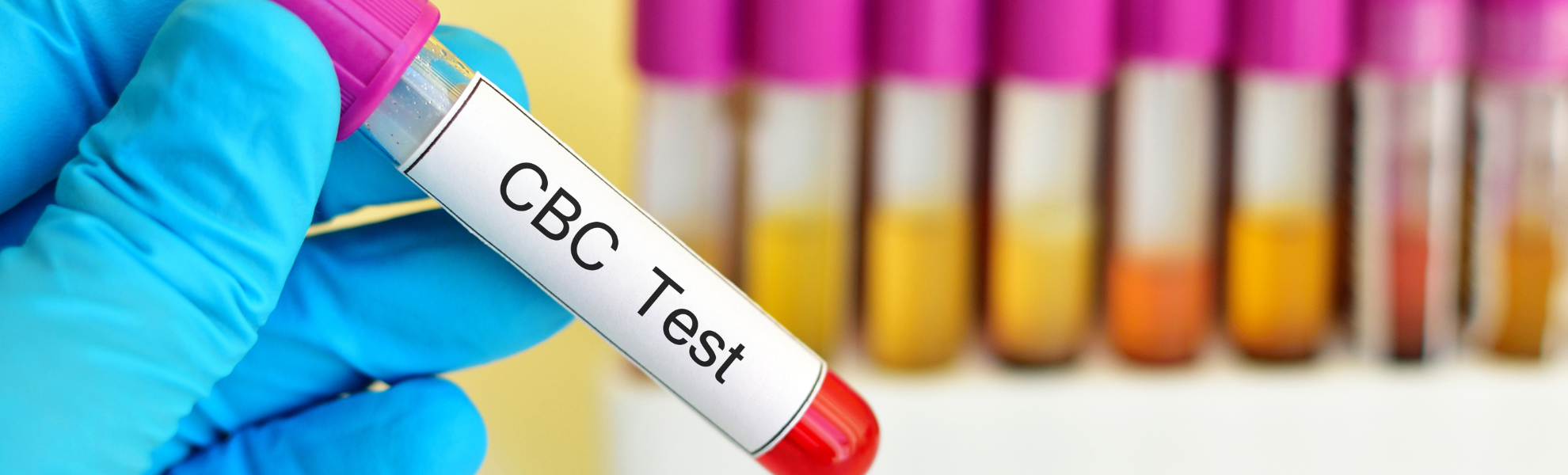 Complete Blood Count Tests