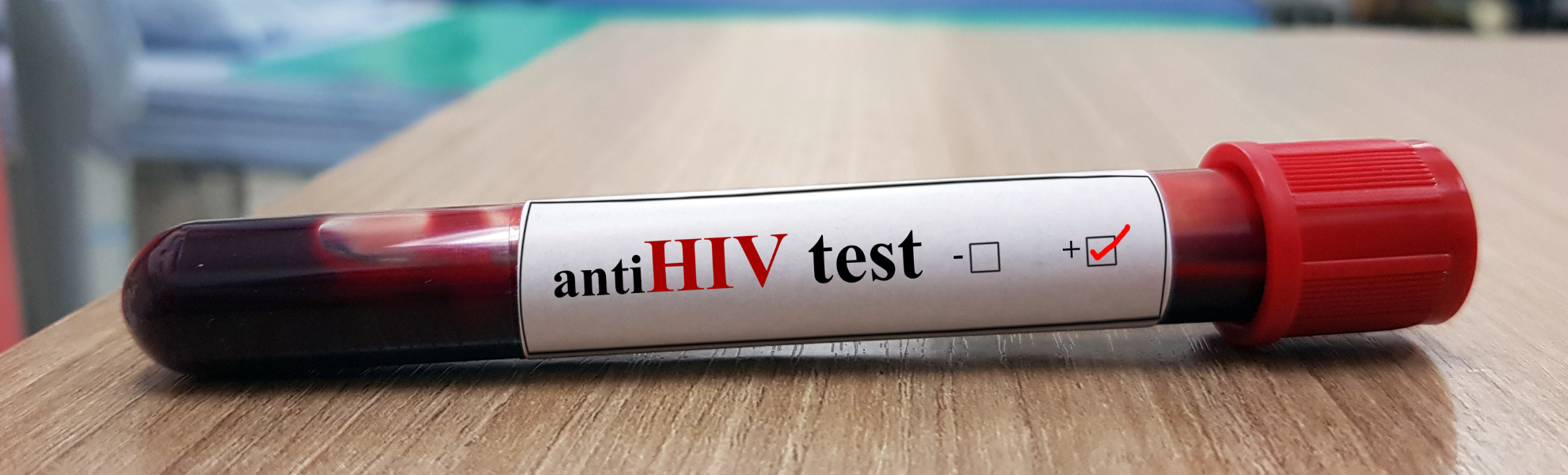Infectious Disease Tests Image Infectious Disease Tests