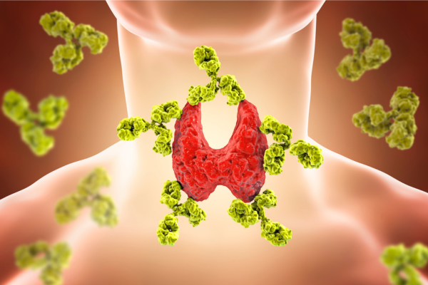 Thyroid Function Tests Image Thyroid Function Tests