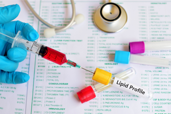 Lipid Profile Test image Lipid Profile Test