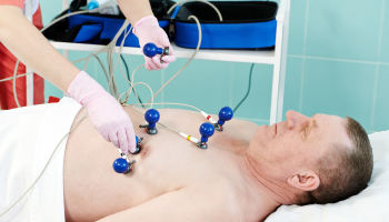 Electrocardiogram (ECG or EKG) Tests image Electrocardiogram (ECG or EKG) Tests