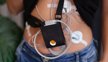 Holter Monitor Test Image Holter Monitor Test
