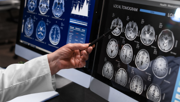 PET Scan