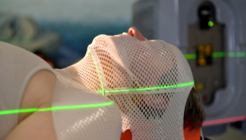 Stereotactic Radiosurgery Image Stereotactic Radiosurgery