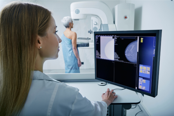Screening Mammography Test image Screening Mammography Test