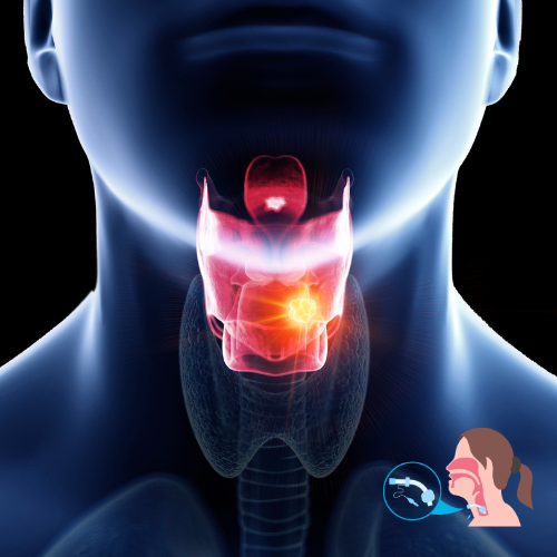Vocal Cord Surgery