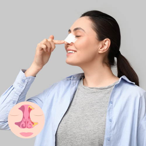 Turbinate Reduction Surgery