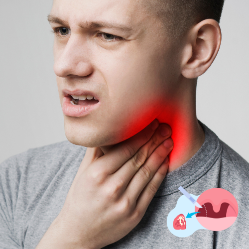 Tonsillectomy Surgery