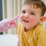 Pediatric Dermatology
