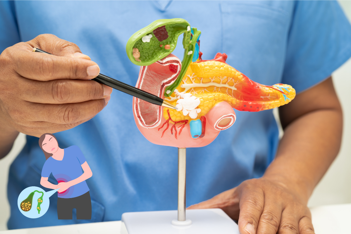 Gallstone Surgery