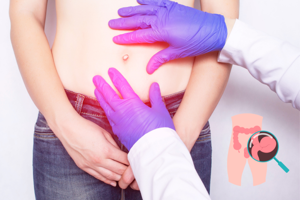 Umbilical Hernia Surgery
