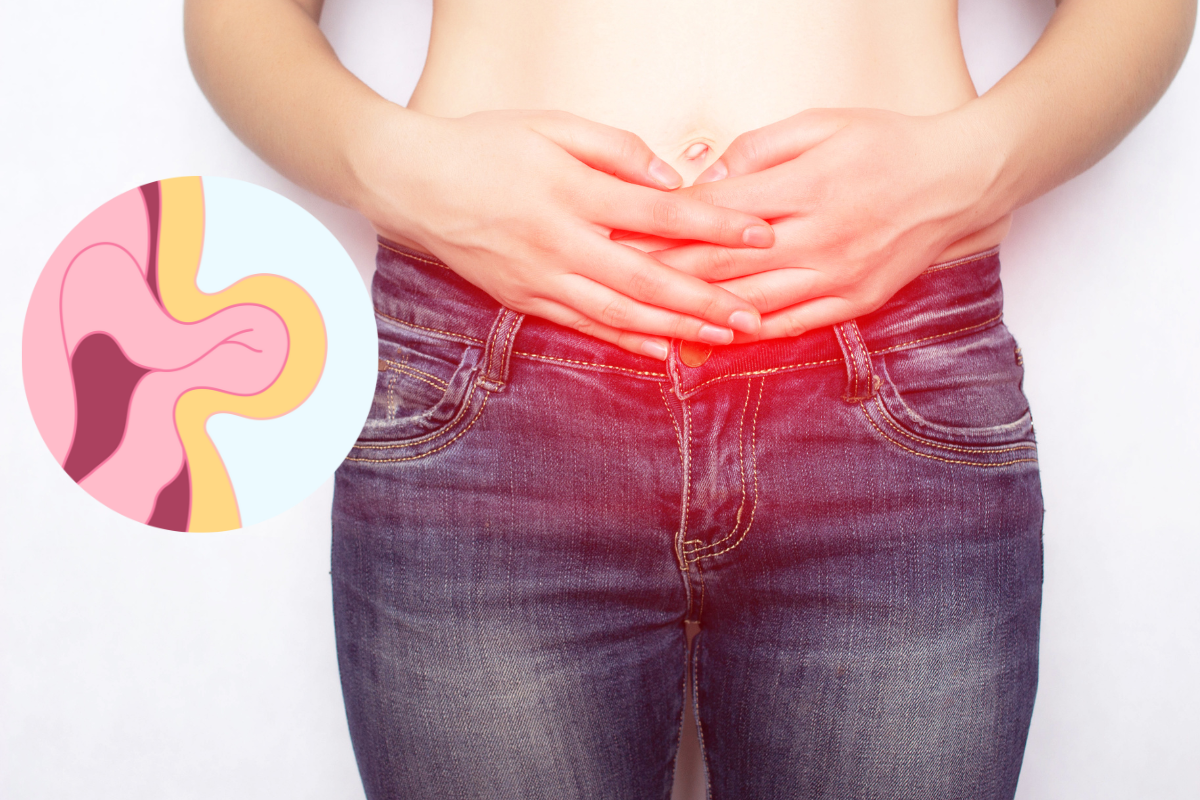 Inguinal Hernia Surgery