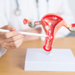 Hysterectomy (Uterus Removal Surgery)
