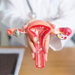 Myomectomy (Fibroid Removal Surgery)