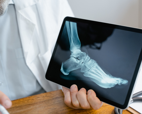 Hand & Foot Surgery โ Precise Treatment for Hands & Feet Disorders
