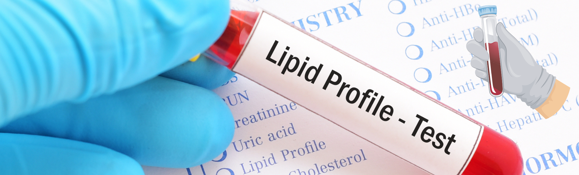 Lipid Profile Test