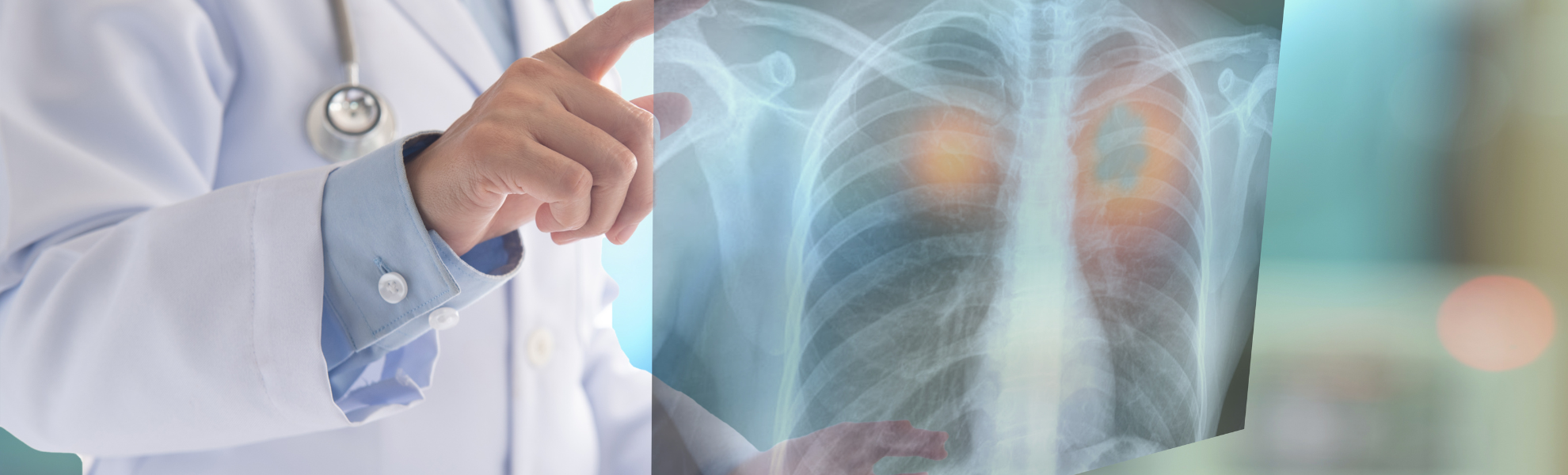 X-Ray ( Radiography ) Test