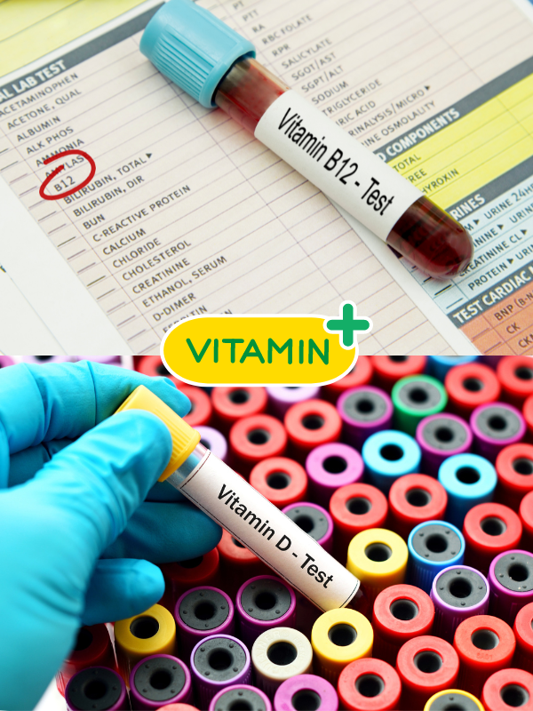 Vitamin & Minerals Tests