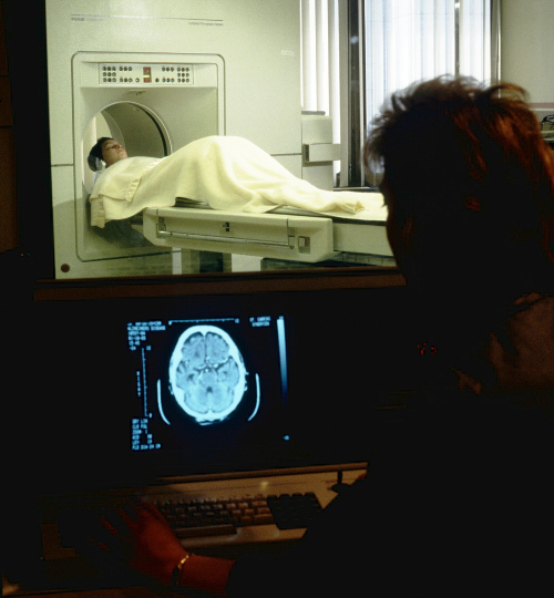 Cerebral Angiography