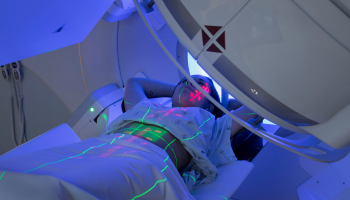 External Beam Radiation Therapy