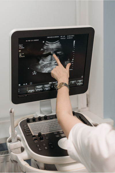 Ultrasound / Sonography Tests