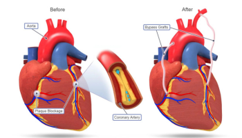Untitled design - 2025-11-10T145221.030