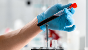 Nizzocare Blood Tests Services